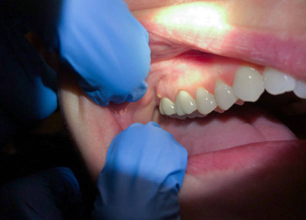 Best Emergency Broken Tooth Repair in New Ulm, MN
