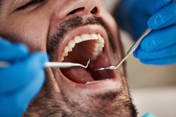 Best Emergency Treatment for Toothache in New Ulm, MN
