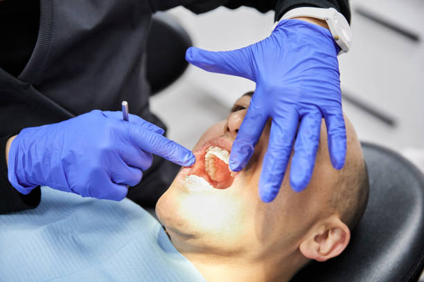 Best Emergency Root Canal Treatment in New Ulm, MN